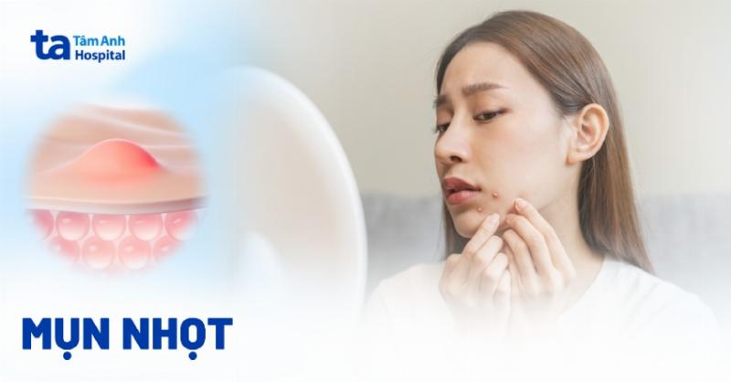 Ảnh hưởng tâm lý khi bị mụn nhọt và cách đối phó